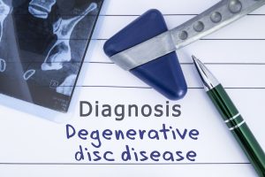 Degenerative Disc Disease Be Caused By A Car Accident